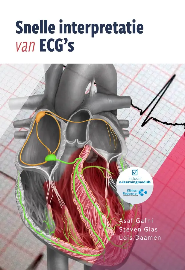 Snelle interpretatie van ECG's