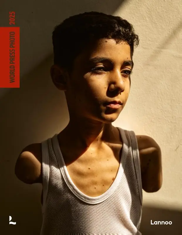 World Press Photo 2025